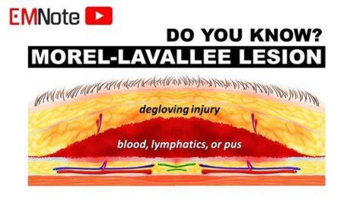 
Mike Lavallee Overhaulin Obituary, What was Mike Lavallee Overhaulin Cause of Death? 