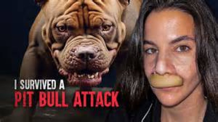 
North Carolina woman loses foot in horrific pit bull attack 