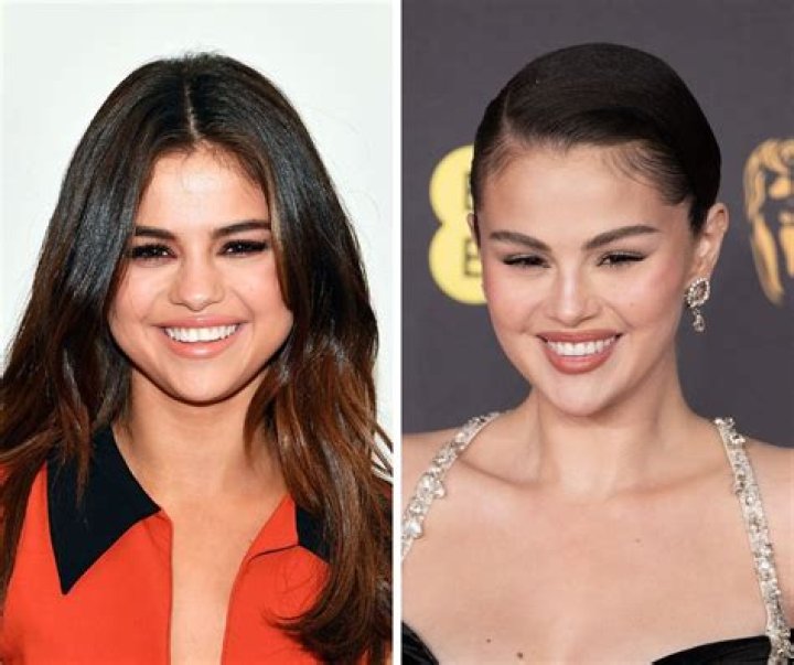 
Sofia Vergara’s Loss Journey And Reasons With Her Before And After Photos 